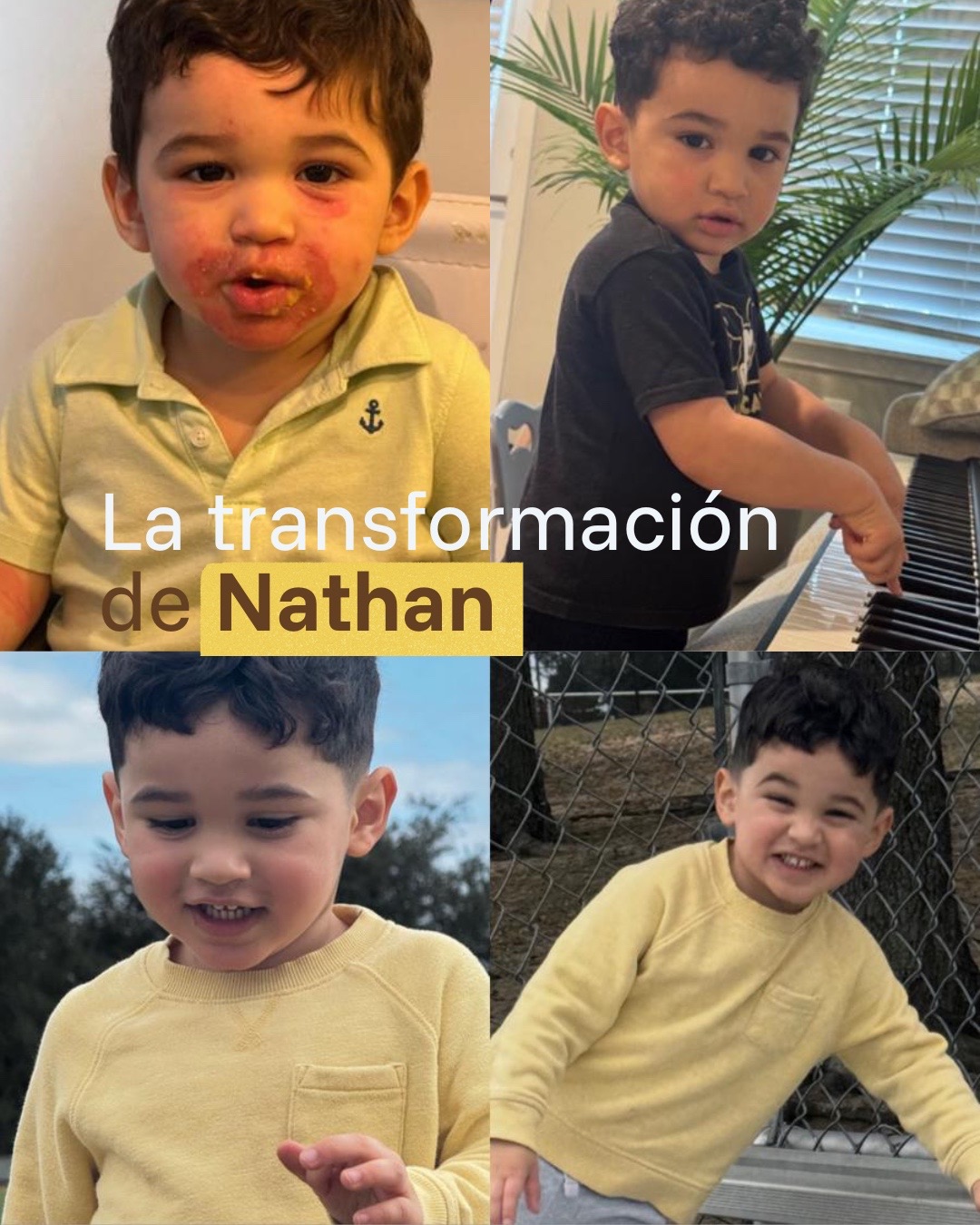 De piel enferma a piel sana - Transformación real de niño con eczema severo